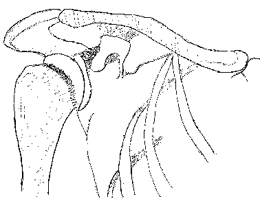 öxl: 